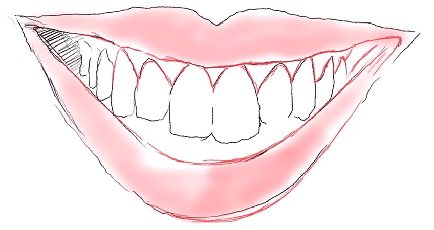 tooth drawing 14