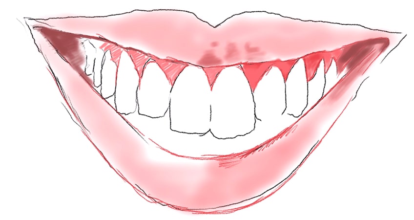 tooth drawing 15
