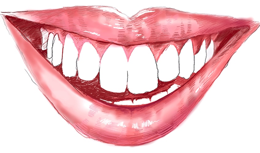 tooth drawing 25